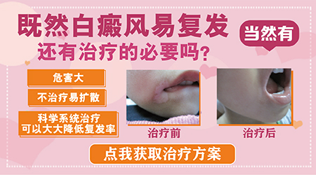 如何才能治好反复发作的白癜风