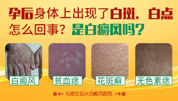 如何区别白癜风和炎症后皮肤色素减退