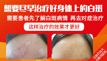 脸上出现白色块图片