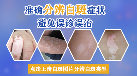 宝宝头皮长了白色小块是什么