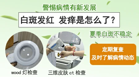 白斑周围皮肤发红是要扩散吗