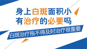 白癜风面积很小有没有治疗的必要
