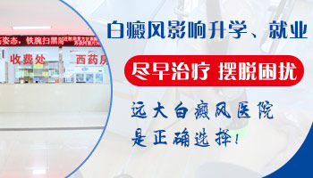 手上的白癜风为什么治不好