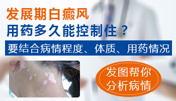 什么药物能控制白癜风发展
