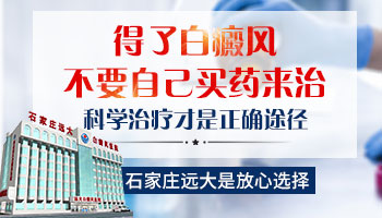 哪家医院有白癜风丸