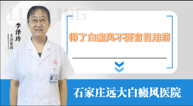 得了白癜风不要盲目用药