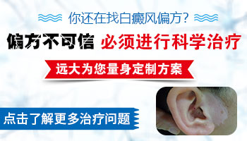 中药泡酒治白癜风的偏方有什么