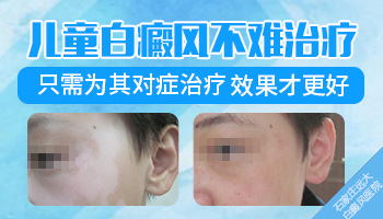 石家庄哪里治疗儿童白癜风ZUI有效果