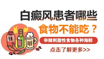 白癜风过年期间能吃点辣吗