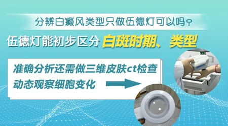 白癜风不同时期在伍德灯下的表现