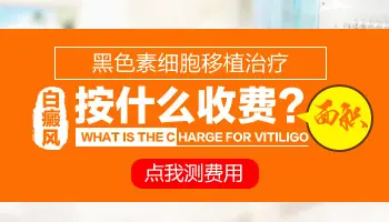 白癜风黑色素移植怎么收费 术后多久恢复正常生活