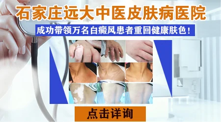 石家庄远大中医皮肤病医院治白癜风专业吗