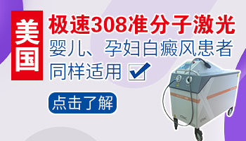 河北省有治疗白癜风的308激光治疗仪吗