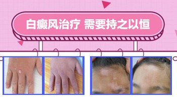 石家庄看白癜风ZUI好的专科医院