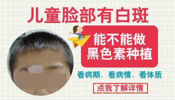 白癜风几岁可以植皮 什么时候才能做植皮