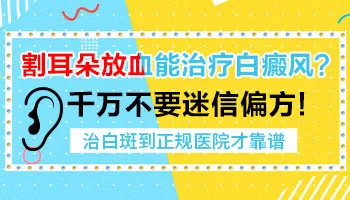 耳尖放血治白癜风效果好不好