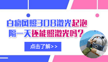 用光疗仪照白癜风起泡是怎回事