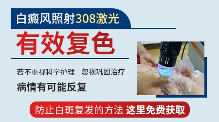 308激光治疗白斑照几次可以长出黑色素
