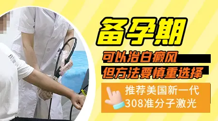 备孕期间白癜风能治疗吗
