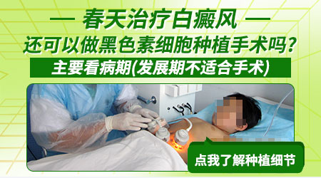 白癜风黑色素种植对技术的要求