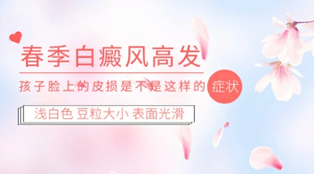 春夏为何白癜风患者病情会变得很严重？