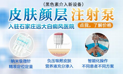 白癜风可以不喝中药吗