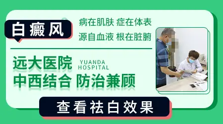 压力太大会不会让白癜风扩散