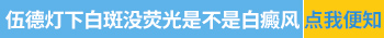 伍德灯检测白癜风颜色和病情轻重有关吗