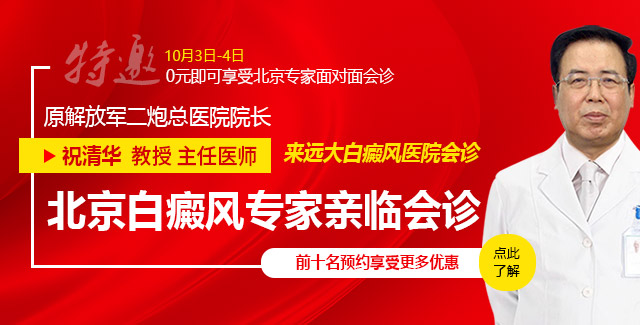 石家庄远大白癜风 祝清华教授