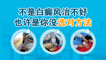 白癜风治不好吗 [白癜风常见的方法]