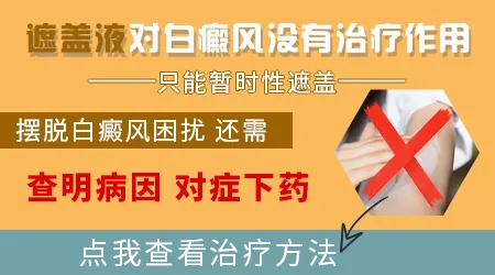 市面上的白癜风遮盖液算治疗药物吗