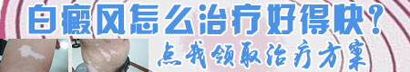 儿童白癜风嘴唇变白了能好吗