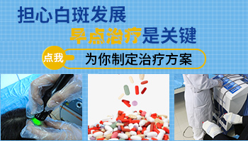 白癜风发展期多久会变大