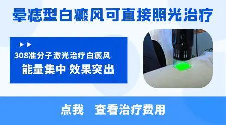 晕痣把痣点了白斑会慢慢恢复吗