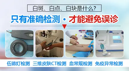 宝宝屁股上有一块泛白是怎么回事