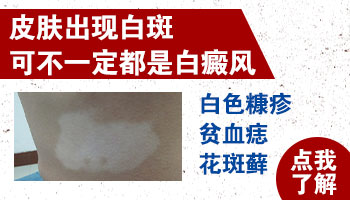 手上长白色的小点点图片