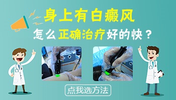 白癜风逐步好转的图片对比