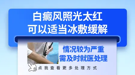 白癜风光疗后出现大面积红肿要怎么处理