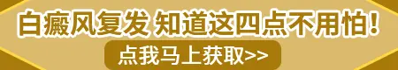 白癜风复发后是不是更难治