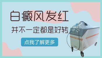 白癜风照激光发红是好转征兆吗