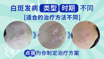 白癜风黑色素细胞培植术不存活怎么办