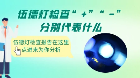 伍德灯检查结果呈蓝白色荧光严重吗