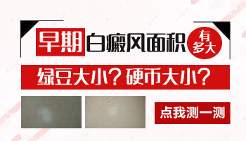 脸上隐约可见一块硬币大小的白斑