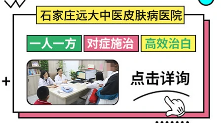 手部白斑怎么治能恢复正常色