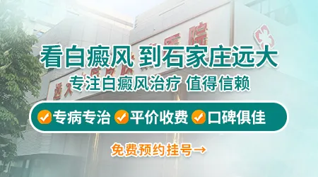 石家庄哪家医院专业看皮肤白斑