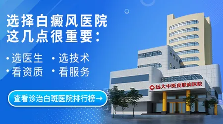 白癜风在石家庄哪个医院看ZUI好