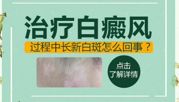 脸部白癜风慢慢恢复其他地方又长新的是为什么