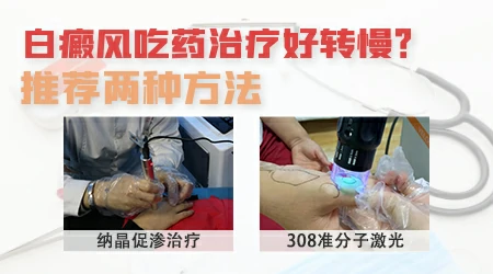 为什么感觉白癜风好转慢 加快白癜风好转的方法有哪些