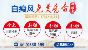 衡水哪里看白癜风好 看白癜风花多少钱