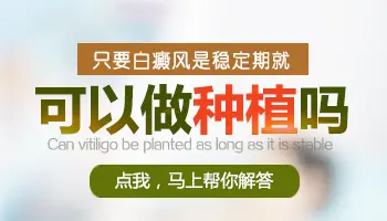 白癜风稳定期可以做移植吗